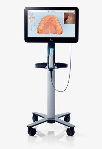 Scanner iTero Lumina em um monitor exibindo digitalização intraoral
